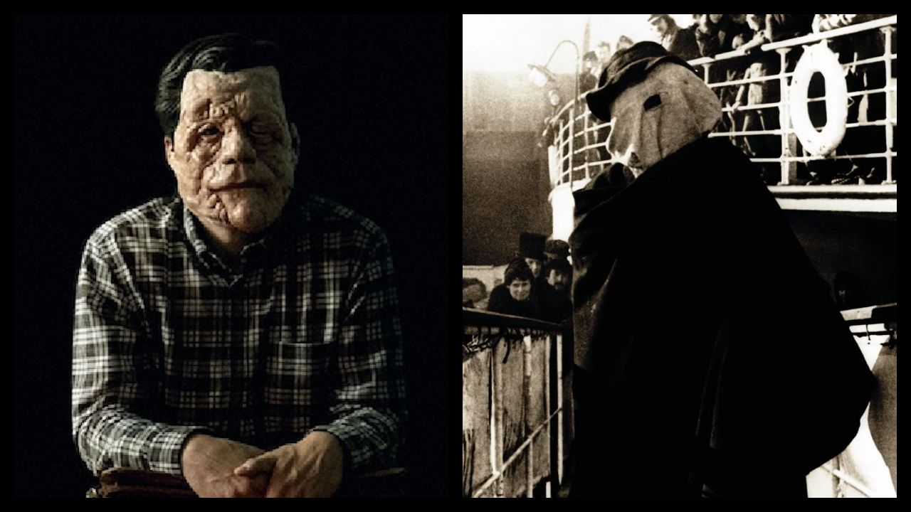 (Left) Adam Pearson in 'A Different Man'. Photo: A24. (Right) John Hurt as John Merrick in 'The Elephant Man'. Photo: Paramount Pictures.